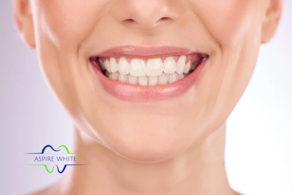 Follow your teeth whitening aftercare  to prolong your whiter smile!